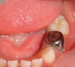 image20230909190740-64fc757914963