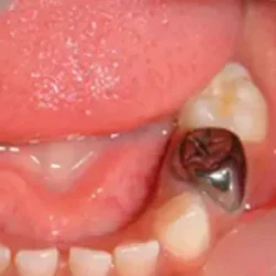 image20230909190740-64fc757914963